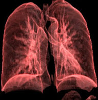 โรคปอดอักเสบ (Pneumonia)